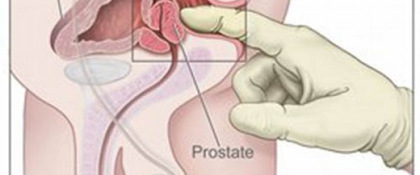 رجل مصاب بورم البروستات وتحليلةPFA ما فيها والو..؟؟