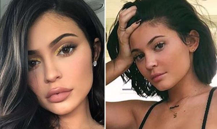 كايلي جينر تزيل مادة الفيلر من فمها وتعود الى طبيعتها (صور)