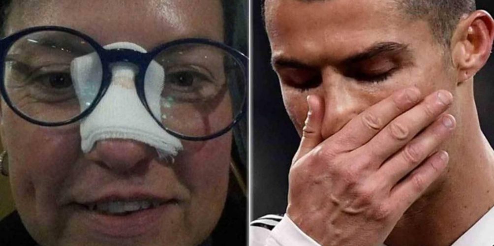 بعدما أصابها بكرة قوية في الوجه.. رونالدو يهدي إحدى مشجعاته قميصه !