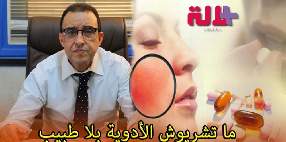 أخصائي في الحساسية: الناس اللي كياخذو الأدوية بلا طبيب كتسبب ليهم في الحساسية (فيديو)