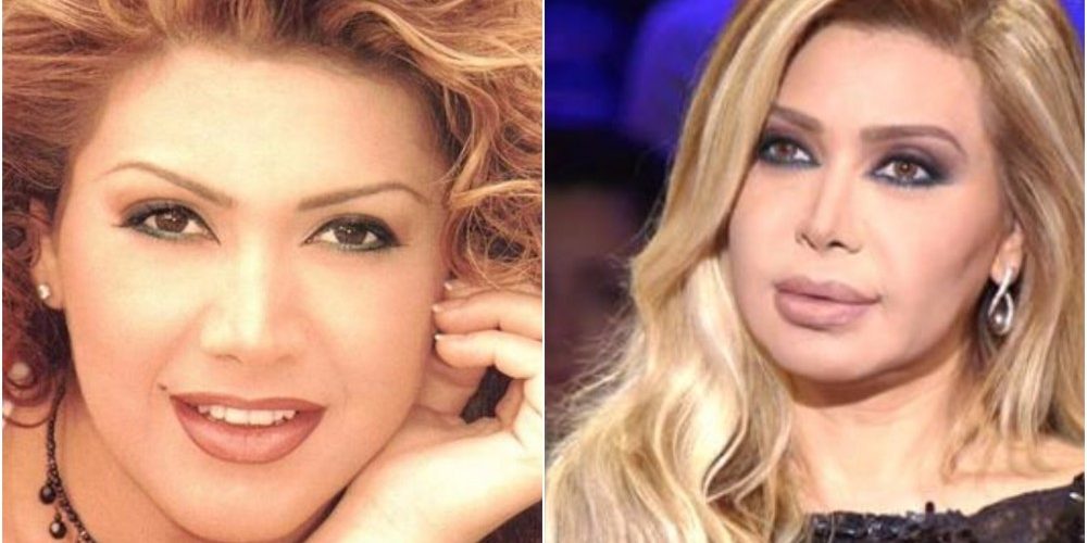 نوال الزغبي نادمة وتؤكد لأول مرة حقيقة خضوعها التجميل (فيديو)