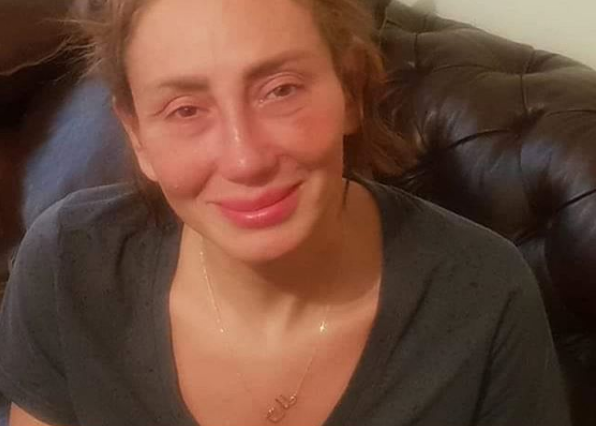 بعد انتشار شائعة إصابتها بمرض جلدي خطير.. ريهام سعيد تخرج عن صمتها