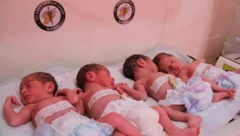 حالة نادرة.. امرأة تحمل بثلاثة توائم في مرتين متتاليتين
