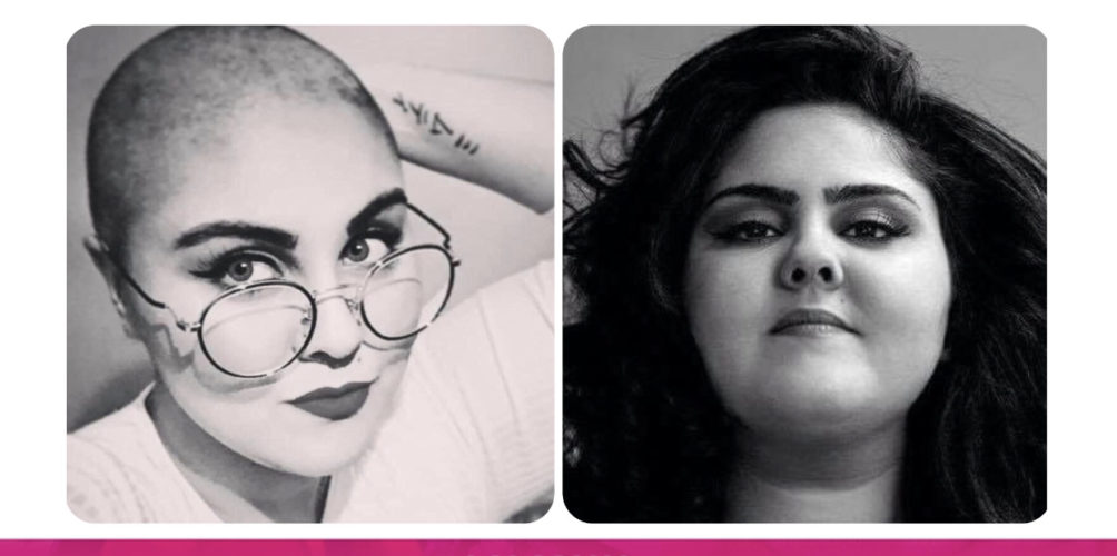 في خطوة جريئة.. عبير العابد تحلق شعرها تضامنا مع النساء اللواتي فقدن شعرهن