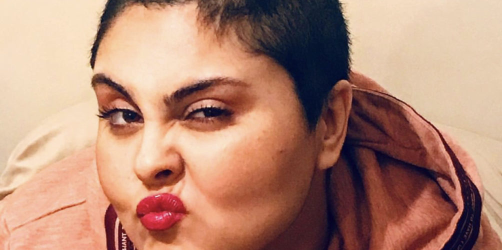 لأنها أصيبت بمرض.. عبير العابد تكشف سبب حلقها شعرها بالكامل (صورة)