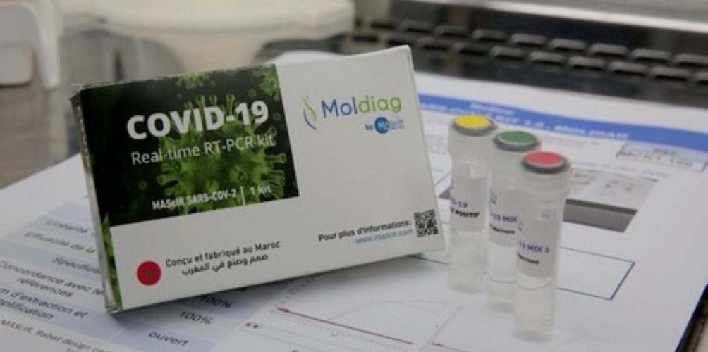 فخر مغربي جديد.. علماء مغاربة يطورون اختبارا لتشخيص كورونا