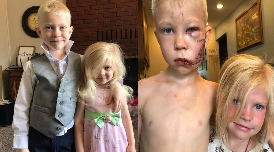 أنقذها من الموت.. طفل يضحي بنفسه من أجل شقيقته ويتحول إلى &laquo;&nbsp;بطل حقيقي&nbsp;&raquo;