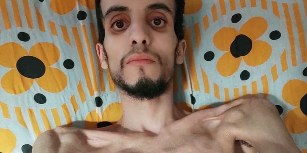 قصته أثرت في مغاربة.. وفاة الشاب نبيل بعد صراع مع السرطان