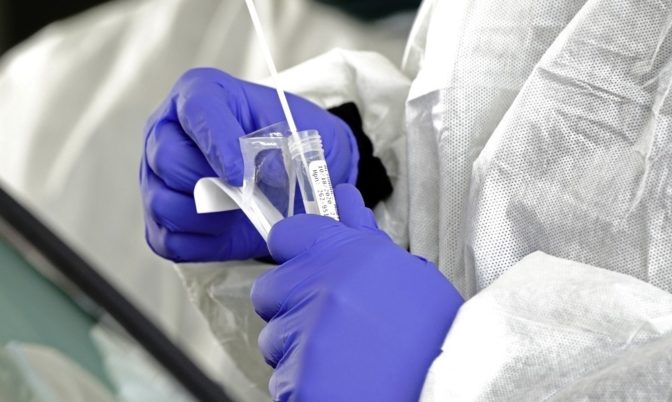 خبراء أمريكيون يحذرون: كورونا الجديد يمكن أن يكون خادعا لاختبارات الإصابة بالفيروس