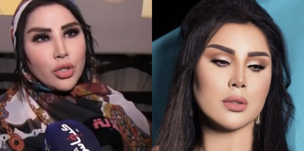 بعد الجدل الذي لاحق تغيير ملامح وجهها.. سعيدة شرف تؤكد خضوعها لعملية تجميل