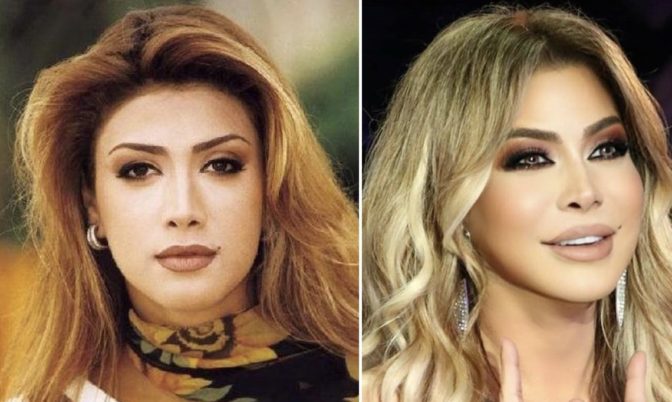 لأول مرة.. نوال الزغبي تكشف السبب وراء تشوه وجهها (فيديو)