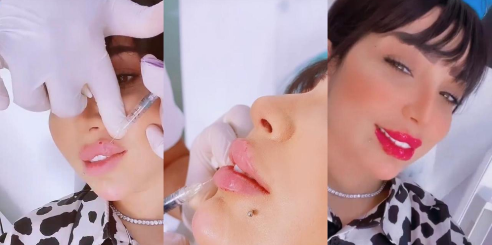 مازال زايدة فيه.. دنيا بطمة تخضع للتجميل من جديد (فيديو)