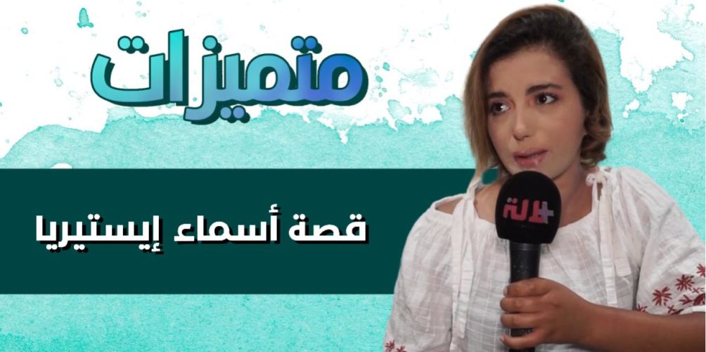 تحدت التشوه في وجهها بالغناء.. قصة أسماء إيستريا (فيديو)