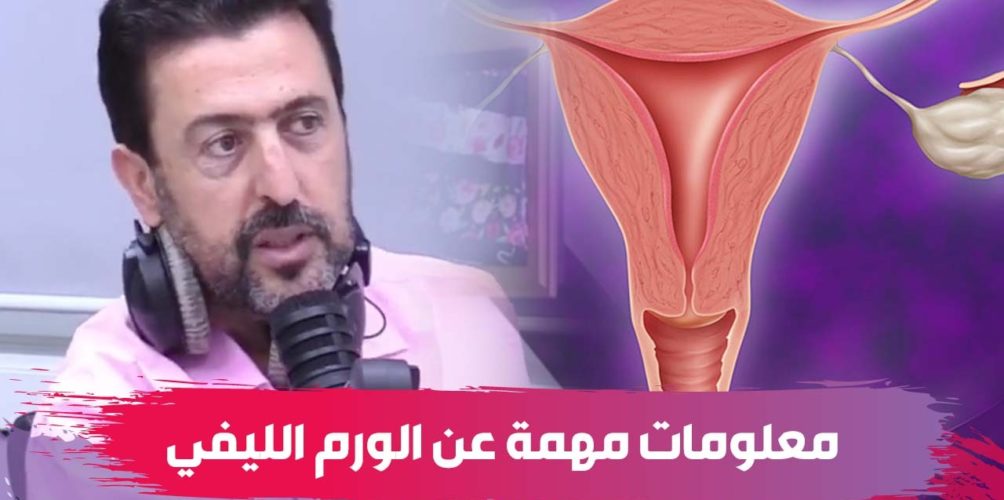 مُنتشر بين السيدات.. معلومات مهمة عن الورم الليفي أو « كورة فالوالدة » على لسان أخصائي (فيديو)