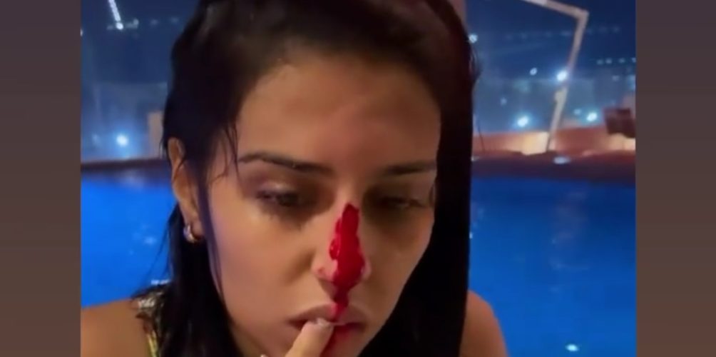 في الدوحة.. الفنانة رجاء بلمير تتعرض لحادث