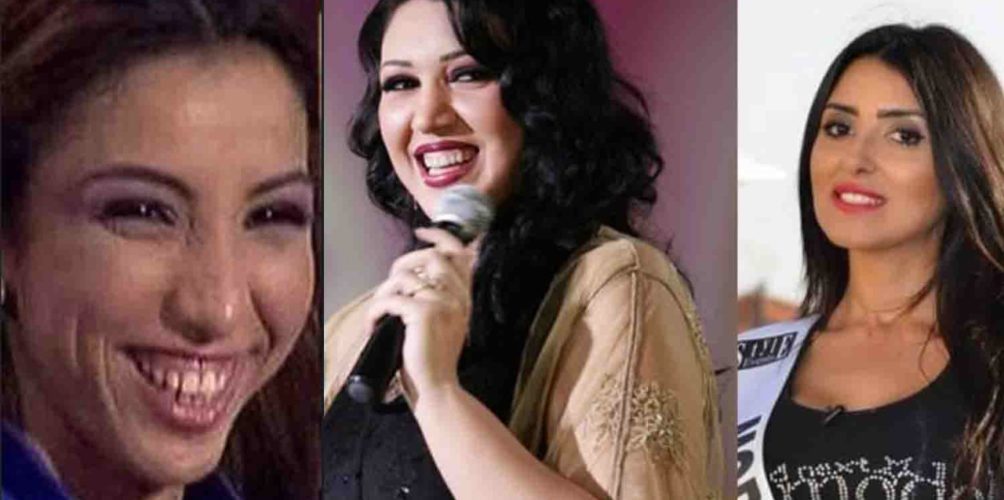 الضحكة بـ 8 ديال المليون.. طبيبة أسنان تكشف تكلفة ابتسامة المشاهير