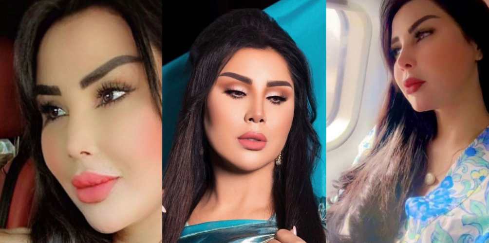 ما بقاوش عرفوها بسبب كثرة عمليات التجميل.. سعيدة شرف تسيفات (صور)