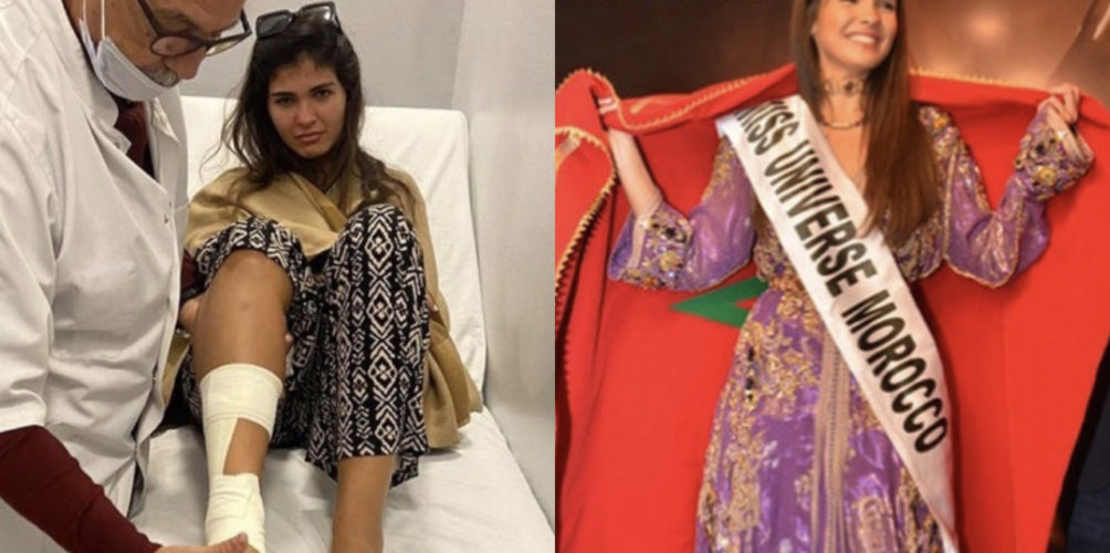 بسبب الإصابة.. ملكة جمال المغرب تتخلى عن لقبها