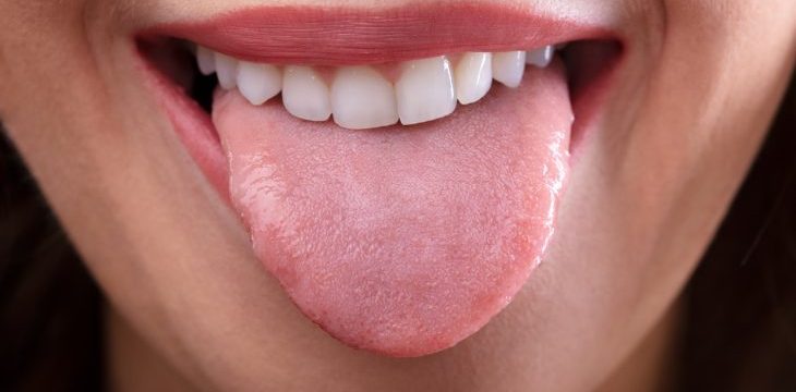 دراسة: البقع الظاهرة على اللسان دليل على تطور مرض السرطان