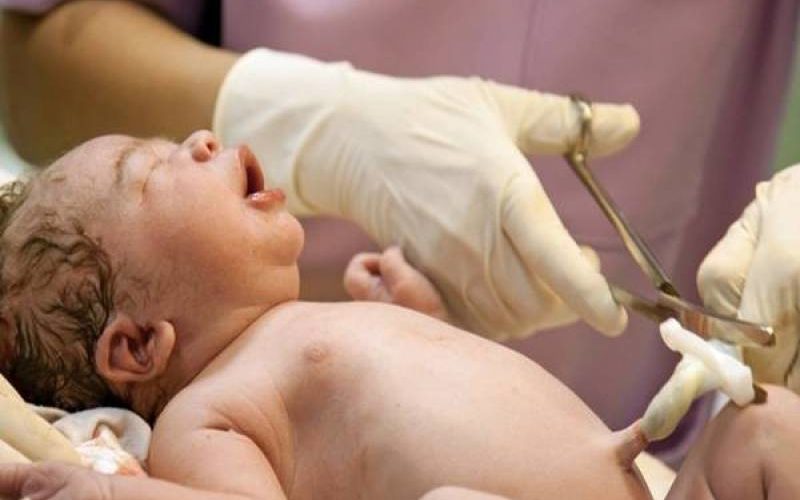 يقلل من خطر الوفاة والإعاقة عند الرضع.. قطع الحبل السري بعد 60 ثانية من الولادة
