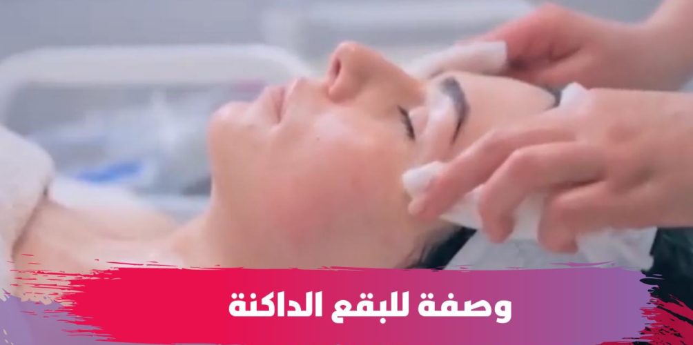 للقضاء على البقع الداكنة.. خبيرة تجميل تنصح بوصفات طبيعية وفعالة (فيديو)