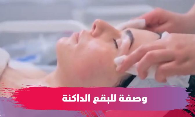 للقضاء على البقع الداكنة.. خبيرة تجميل تنصح بوصفات طبيعية وفعالة (فيديو)