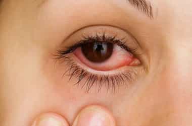 هل التهاب العين من أعراض أوميكرون؟.. خبراء يجيبون