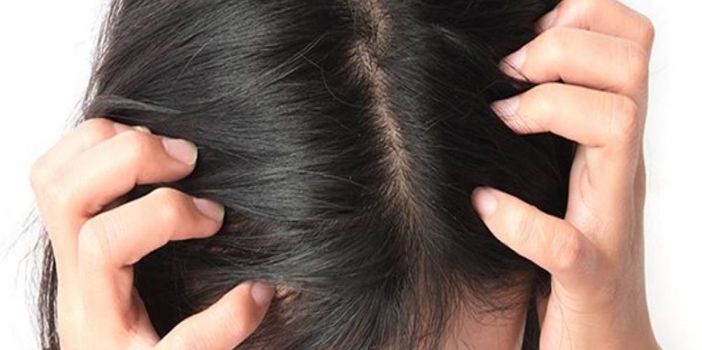 انبعاث رائحة كريهة من الشعر.. خبراء يكشفون الأسباب