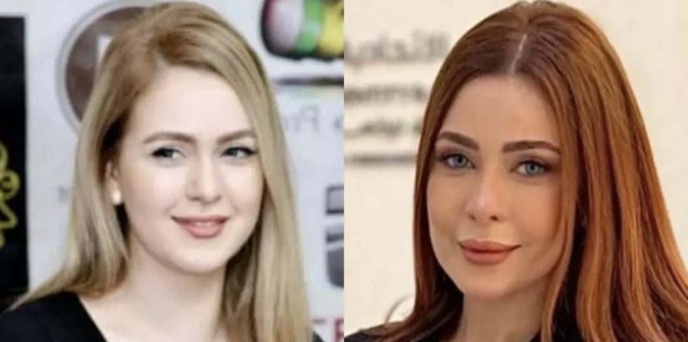 بسبب تغير ملامح وجهها.. رواد مواقع التواصل الاجتماعي ينتقدون خضوع خولة بنعمران للتجميل (صور)