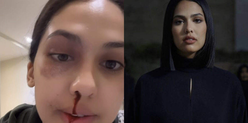 بعد أغنية « عاري ».. منال بنشليخة تطلق حملة لوقف العنف ضد النساء