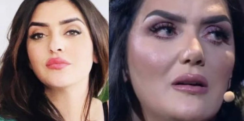 تغيرت ملامح وجهها بسبب التجميل.. نرجس الحلاق تتعرض لوابل من الانتقادات