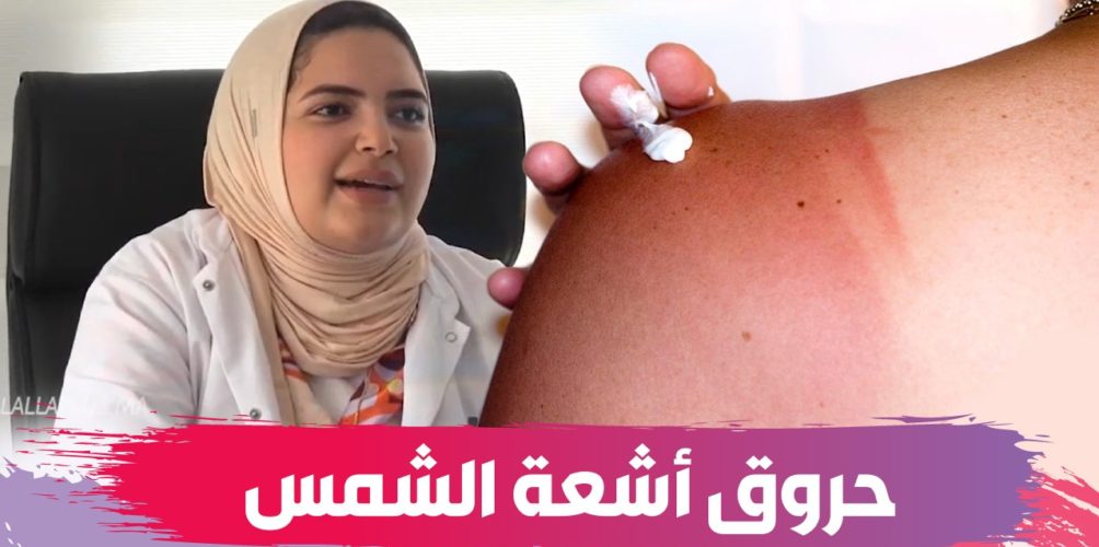 لتجنب الحروق وشيخوخة البشرة.. أخصائية توجه نصائح لحماية الجلد من أشعة الشمس