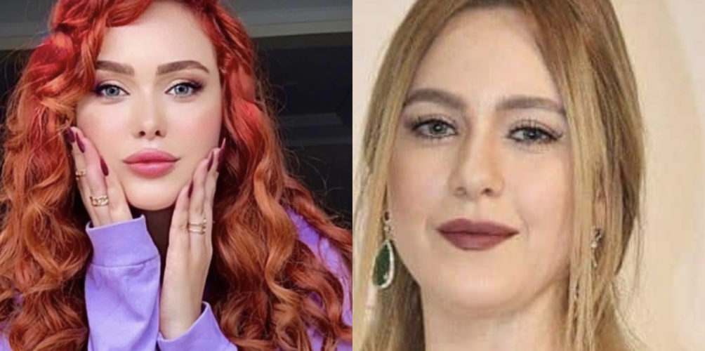 تبدلات.. مغاربة ينتقدون خضوع خولة بنعمران للتجميل ويفضلون شكلها السابق