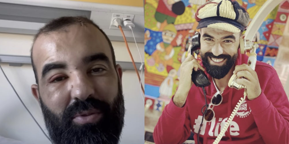 أجرى عملية جراحية.. حميد الحضري يعلن إصابته بورم في الرأس (فيديو)