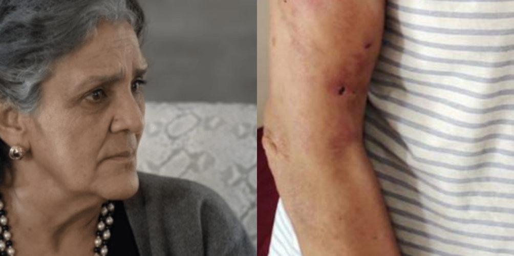 عضها كلب.. الممثلة راوية تتقدم بشكاية لدى مصالح الأمن