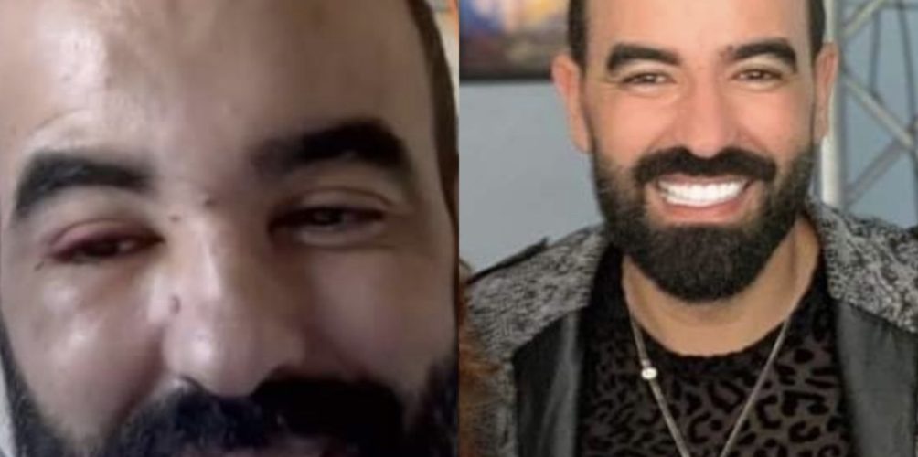 رغم معاناته مع مرض السرطان.. حميد الحضري يبعث برسالة تفاؤل عبر « كولشي على الله »