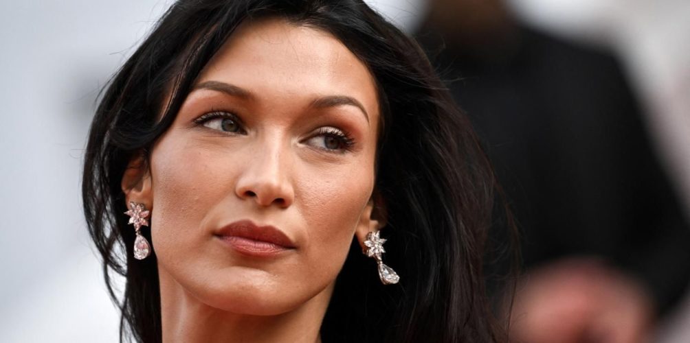 كدمات وضمادات تغطي جسدها.. بيلا حديد تقلق الجمهور على صحتها (صور)